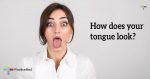 How-does-your-tongue-look