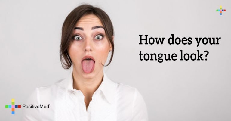 How does your tongue look? How does your tongue look?