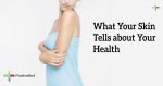 What-Your-Skin-Tells-about-Your-Health