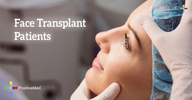 Face Transplant Patients