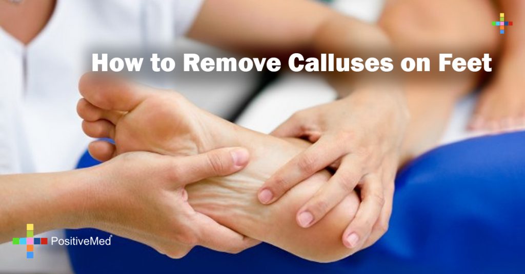 How to Remove Calluses on Feet