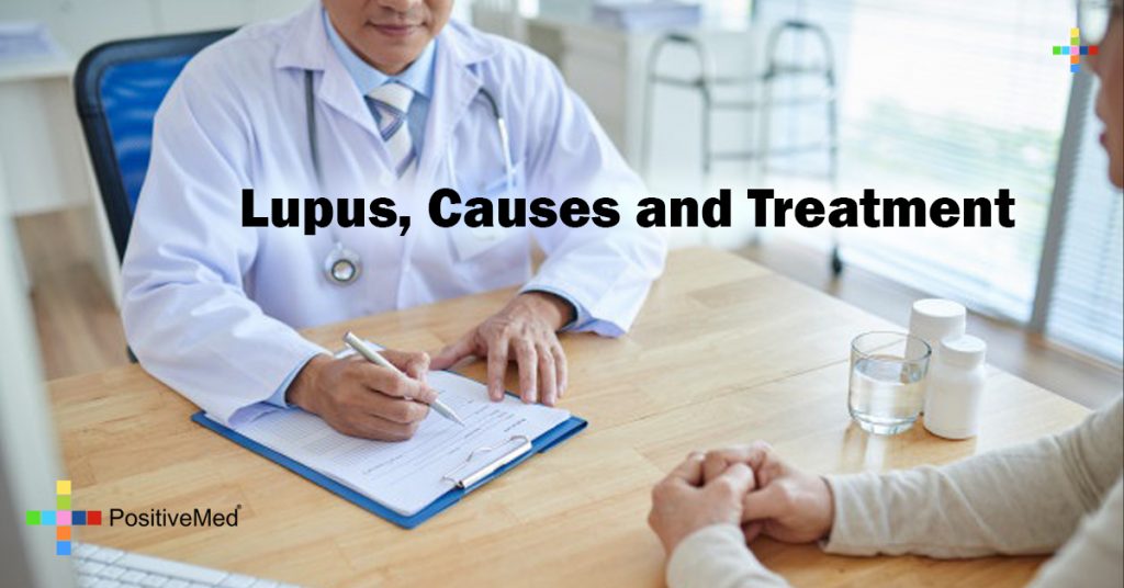 Lupus, Causes and Treatment