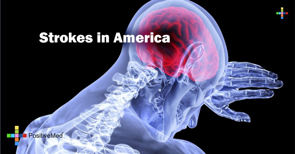 Strokes in America