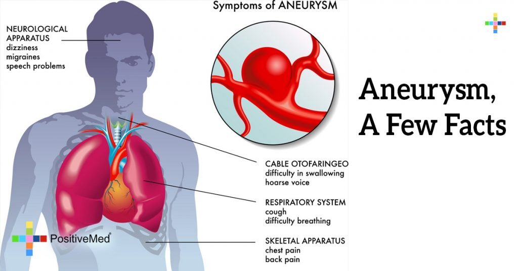 Aneurysm, A Few Facts