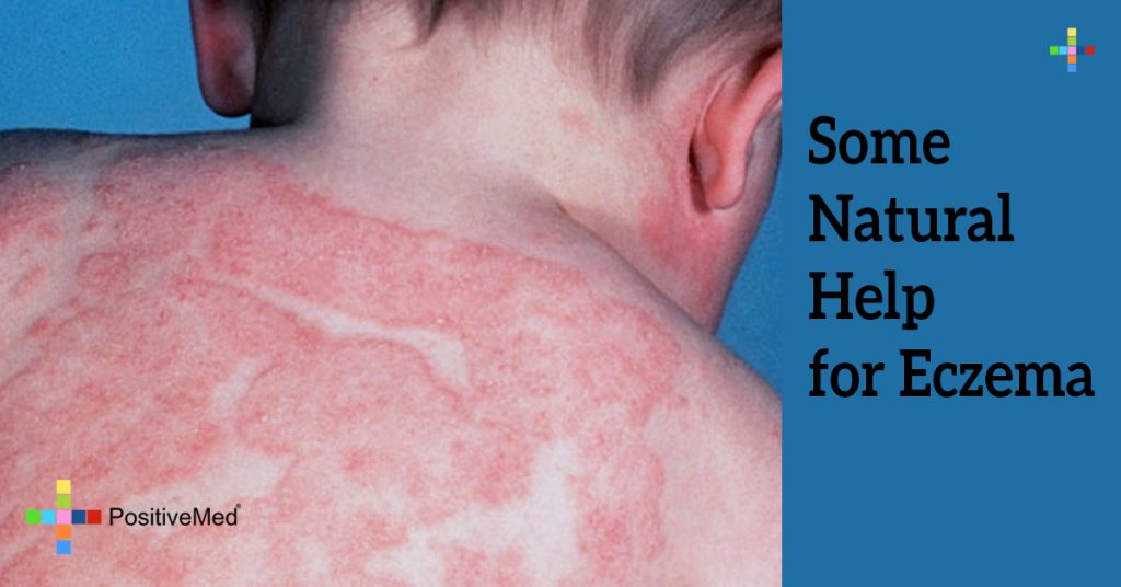 Some Natural Help for Eczema
