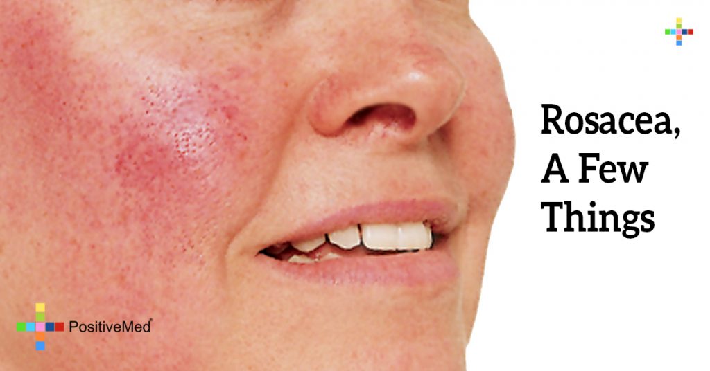 Rosacea, A Few Things