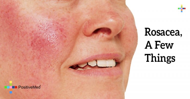 Rosacea, A Few Things Rosacea, A Few Things