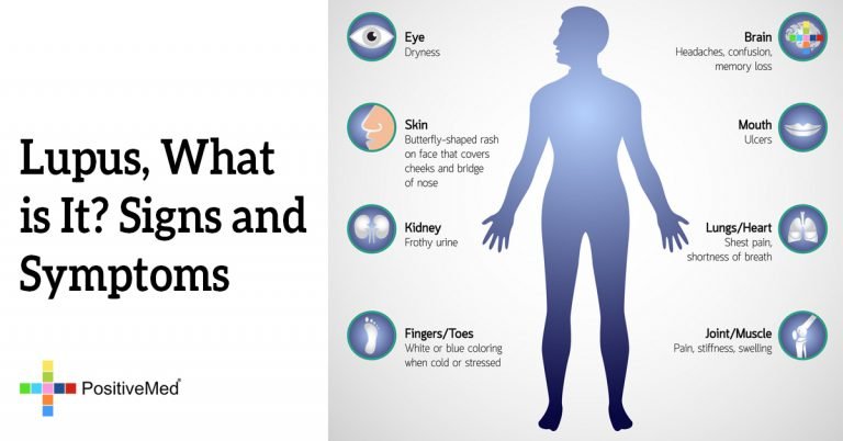 Lupus, What is It? Signs and Symptoms