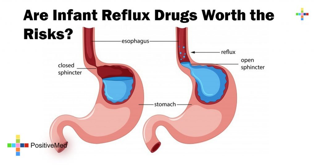 Are Infant Reflux Drugs Worth the Risks?  