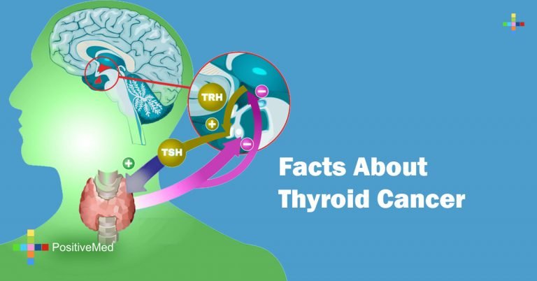 Facts About Thyroid Cancer