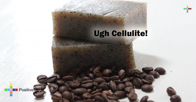 Ugh Cellulite! Ugh Cellulite!