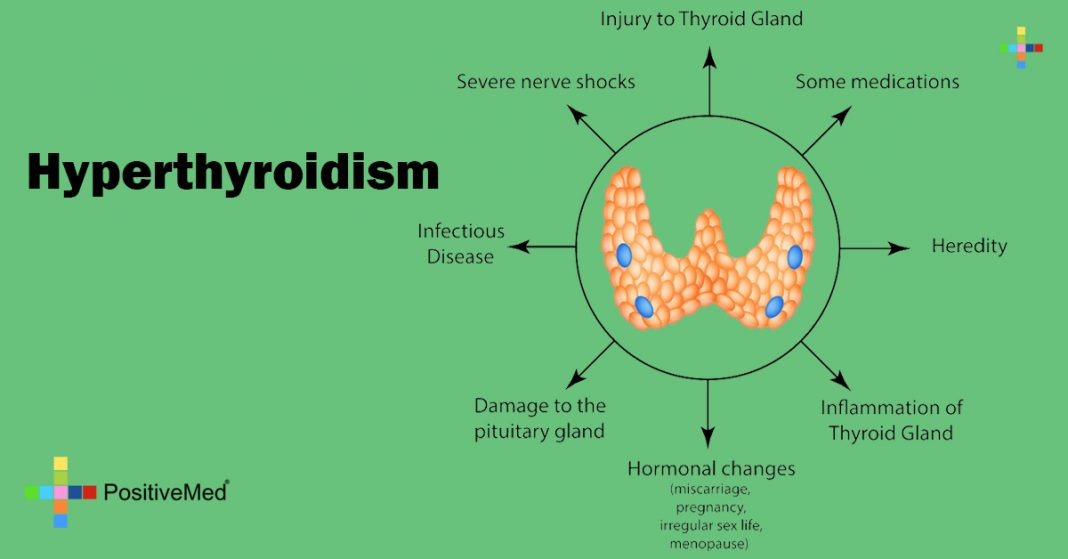 hyperthyroidism sweating