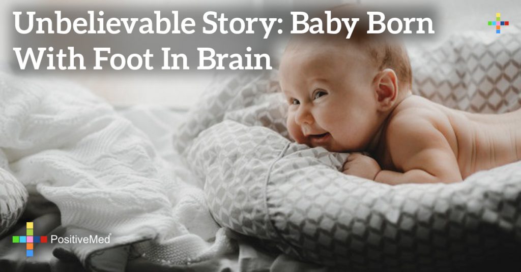 Unbelievable Story: Baby Born With Foot in Brain